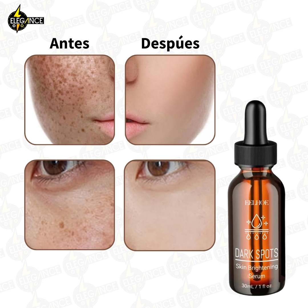 DESPIGMENTANTE FACIAL Y CORPORAL