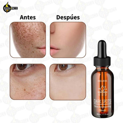 DESPIGMENTANTE FACIAL Y CORPORAL